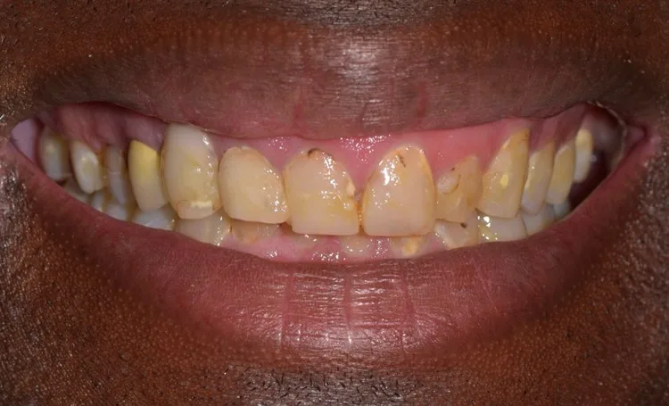 Before — Case 4