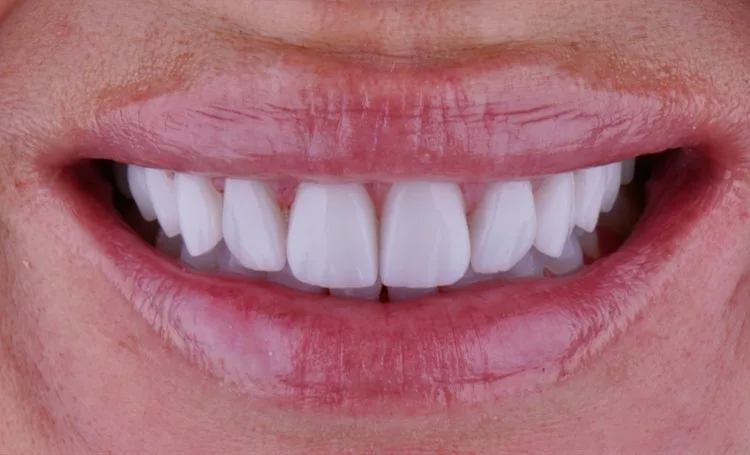 After — Case 5
