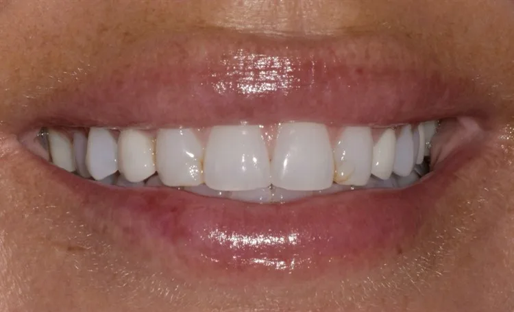 Before — Case 5