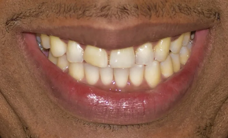 Before — Case 6