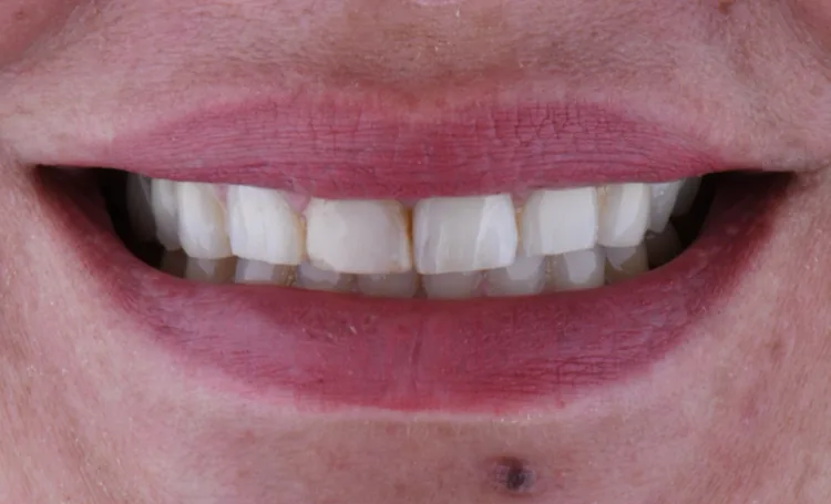 Before — Case 7