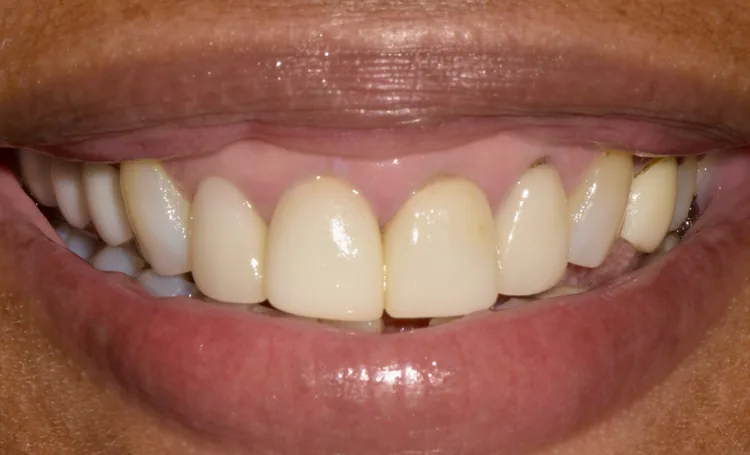 Before — Case 8