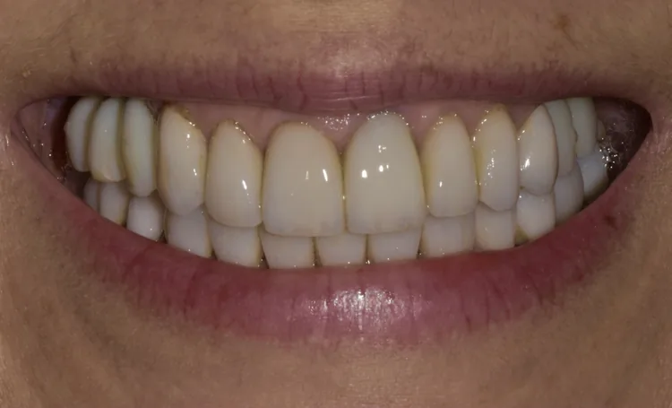 Before — Case 9