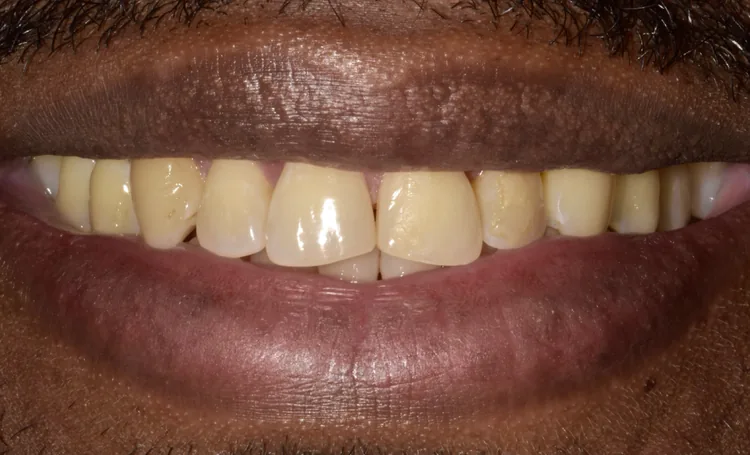 Before — Case 10
