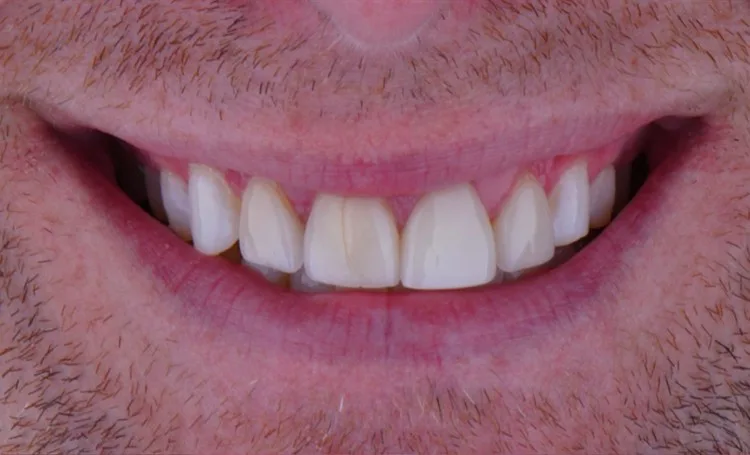 Before — Case 1