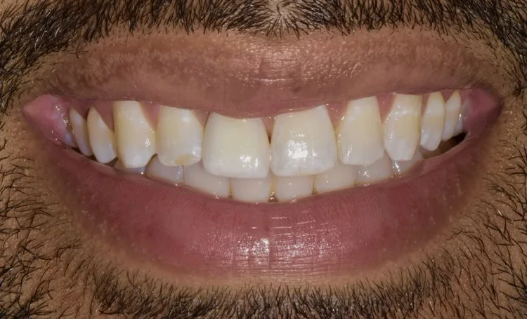 Before — Case 2